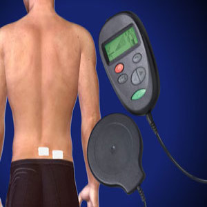 Spinal Cord Stimulator Implant in Plano, Frisco, McKinney and Allen