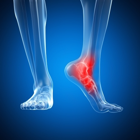 Orthopedic Foot & Ankle Surgery in Plano, Frisco, McKinney and Allen