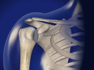 What is a Shoulder subluxation/dislocation