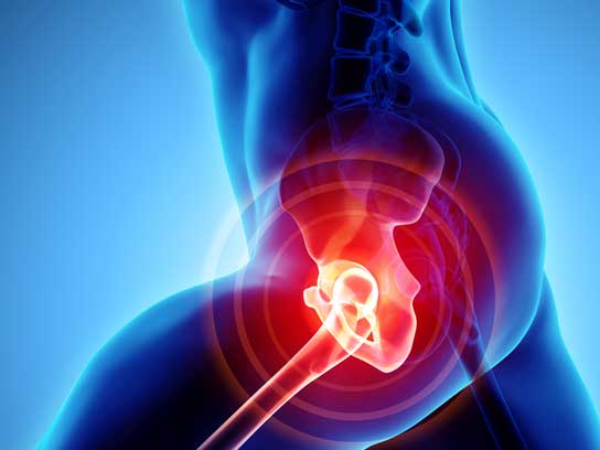 Hip Joint Replacement Surgery in McKinney