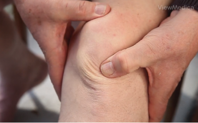 What Type of Therapy Is Needed After Knee Surgery?